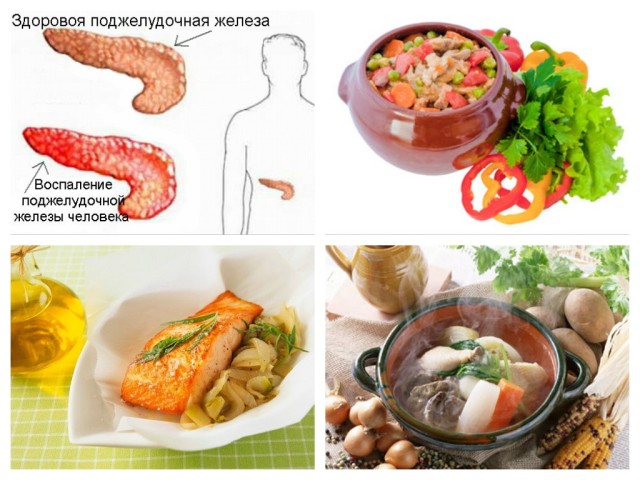 Diet for pancreatitis of the pancreas: an approximate menu, permitted products, recipes. Diet for acute pancreatitis of the pancreas