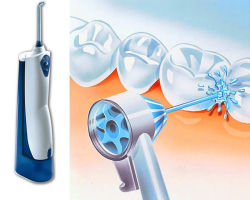 How to use it correctly, brush your teeth with an irrigator for the oral cavity, water under pressure: instructions, dentist advice. How to choose and buy an irrigator, portable for the oral cavity for Aliexpress: review, links to a catalog with price, reviews, photos