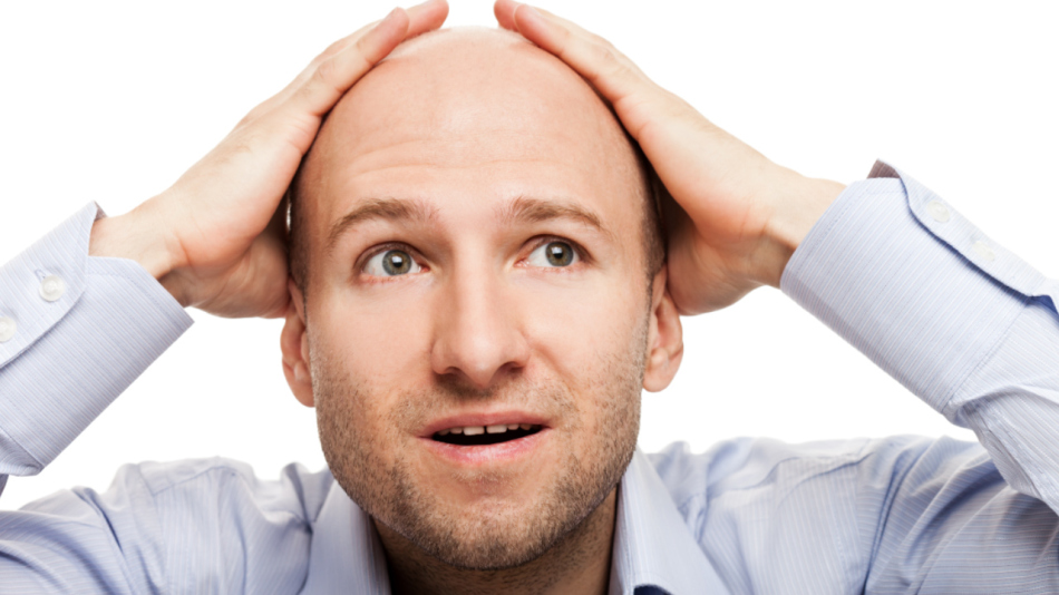 Excessive dihydotestosterone - the root cause of baldness