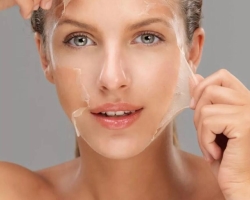 Acid face peeling: Indications, how to make the right photo before and after, reviews. The best acidic acids for home use