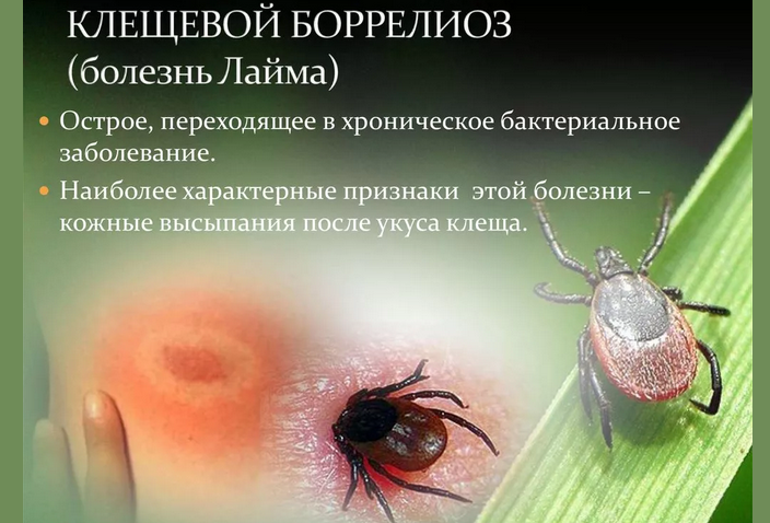 Tick \u200b\u200b-Borne Borreliosis