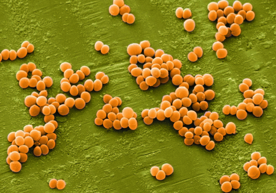 Staphylococcus segély mikroszkóp alatt