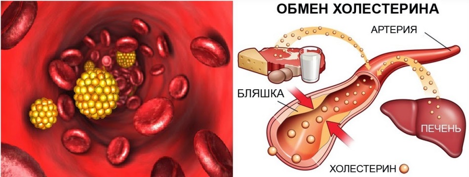 That you can’t eat and do with increased cholesterol: tips