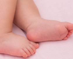 Покраснения и зуд между пальцев на ногах у ребенка: причины, диагностика, какой врач лечит?