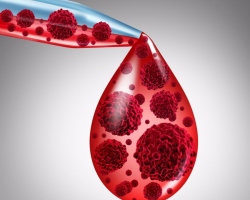 Dari mana darah mengental: penyebab, produk yang mengkondensasi darah