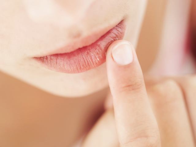 Piling heil ustnice: vzroki, simptomi, zdravljenje