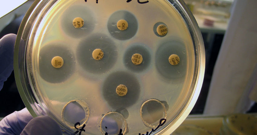 Decoding dan norma analisis tinja untuk sensitivitas terhadap antibiotik