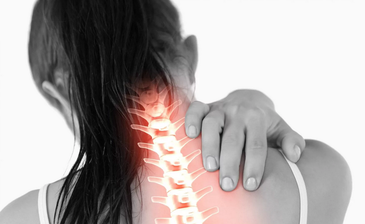 Osteochondrosis, hernia tulang belakang leher
