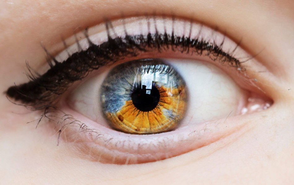 Sektor s heterohromi očesa