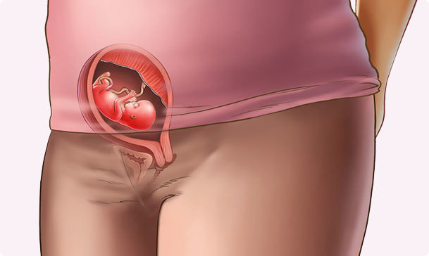 Fleet consolidation in the uterus