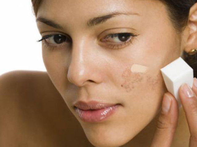 Des taches de pigment sur le visage - comment se déguiser? Pourquoi les taches d'âge apparaissent-elles sur le visage et comment s'en débarrasser?