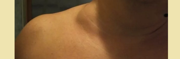 Increased and hurts the lymph node on the neck on the left side