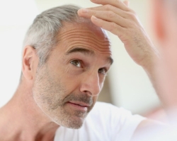 Why does the hair fall out in men and what to do with it? The first signs of baldness in men - how to recognize? How to restore hair to a man with baldness?