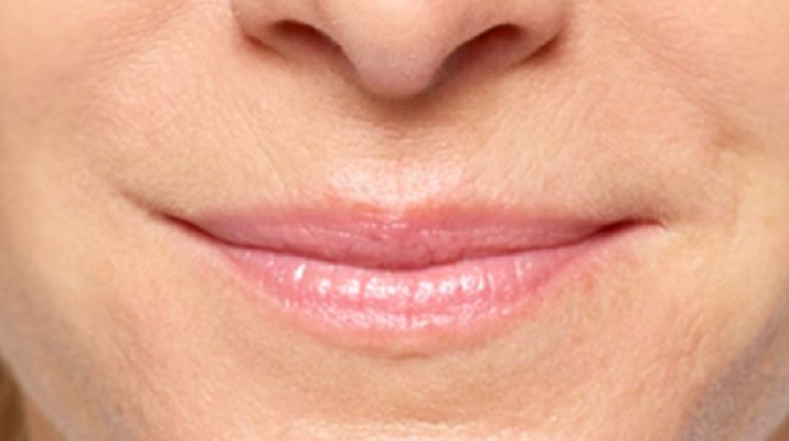 Exercises for the corners of the lips