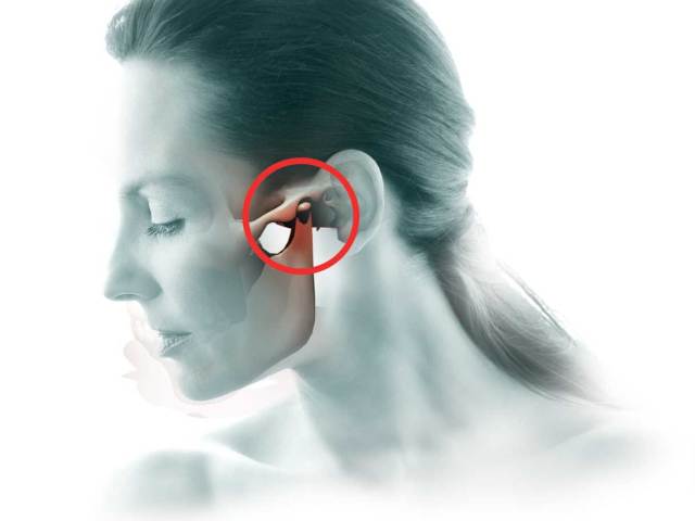 Γιατί το ζαχαρωτό και το σαγόνι έχουν πόνο κοντά στο αυτί στα αριστερά και δεξιά, πονάει να μασάει: Αιτίες, θεραπεία. Το σαγόνι κάνει κλικ στη μία πλευρά και η άρθρωση του γνάθου και του ζυμώματος πονάει όταν ανοίγει το στόμα: τι να κάνει, ποιος γιατρός να επικοινωνήσει; Αρθογραφία σαγόνι: συμπτώματα, θεραπεία
