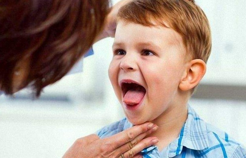 A gyermek nyelvét ellenőrizni kell - ez a belső szervek állapotának mutatója