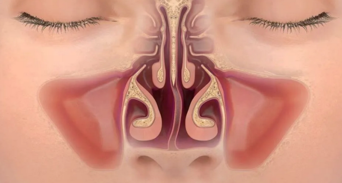 The curvature of the nasal septum