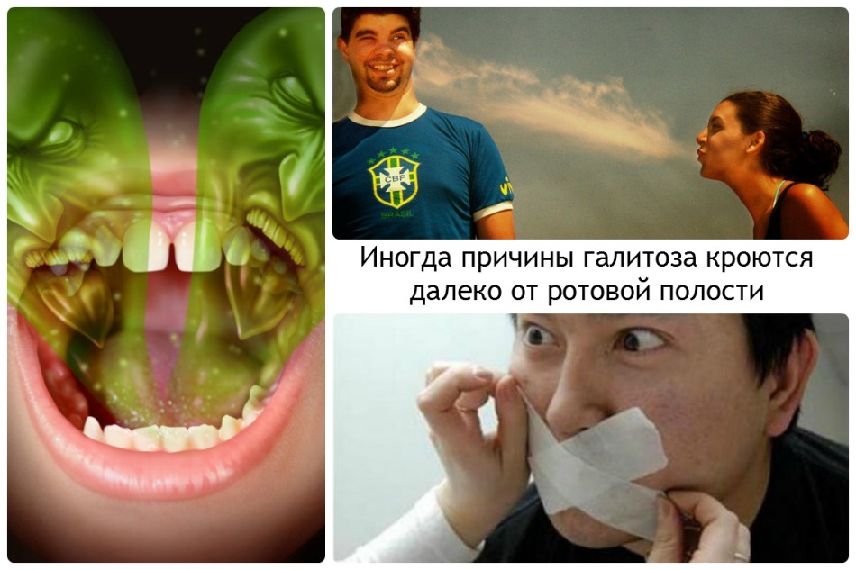 It smells bad from the mouth: the causes of galitosis
