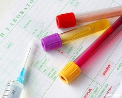 Kaj je HCG? Kdaj narediti krvni test, HCG test?