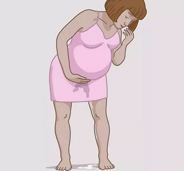 Vous ne pouvez pas remarquer et manquer la décharge du liquide amniotique chez une femme avant l'accouchement
