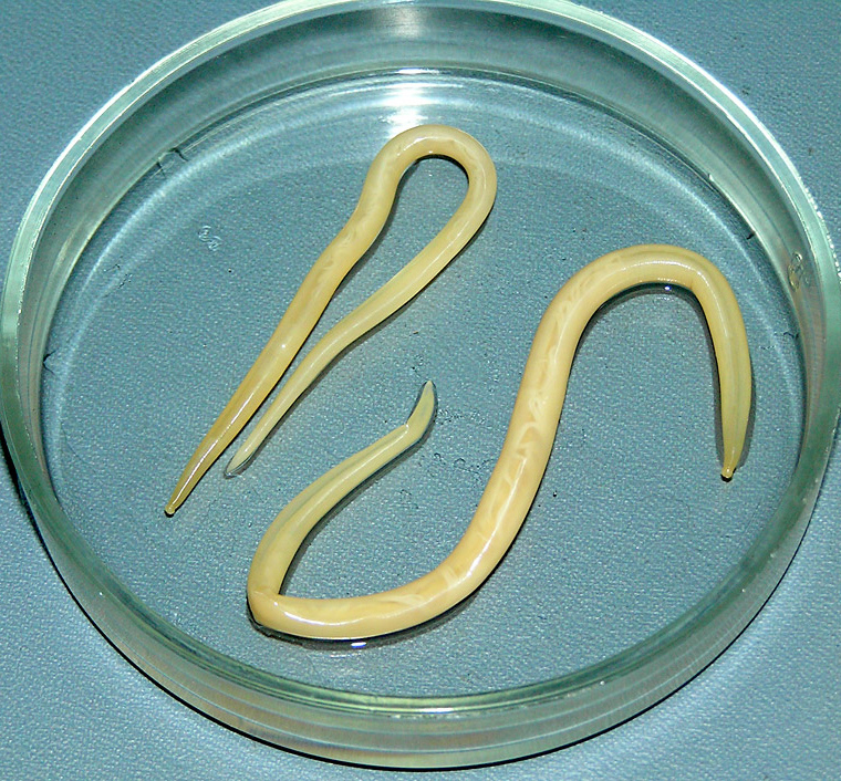 Types of worms in a child
