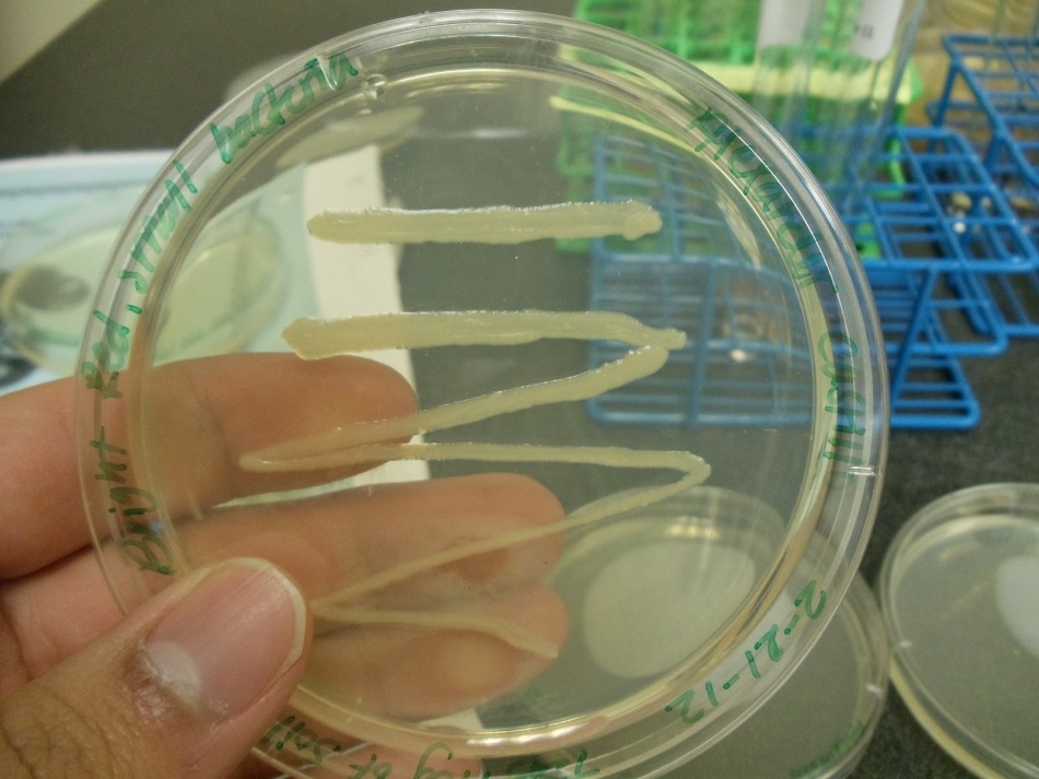 Citrobacter dalam analisis tinja