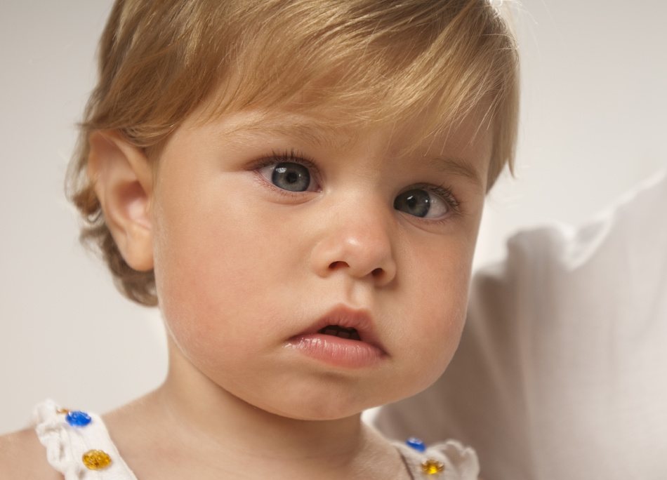 Con lo strabismo nei bambini, la parallelità degli assi visivi degli occhi è disturbata.