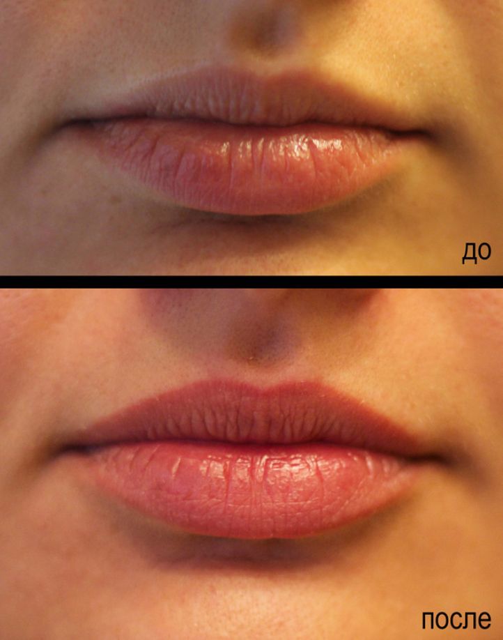 Lip contour - shading