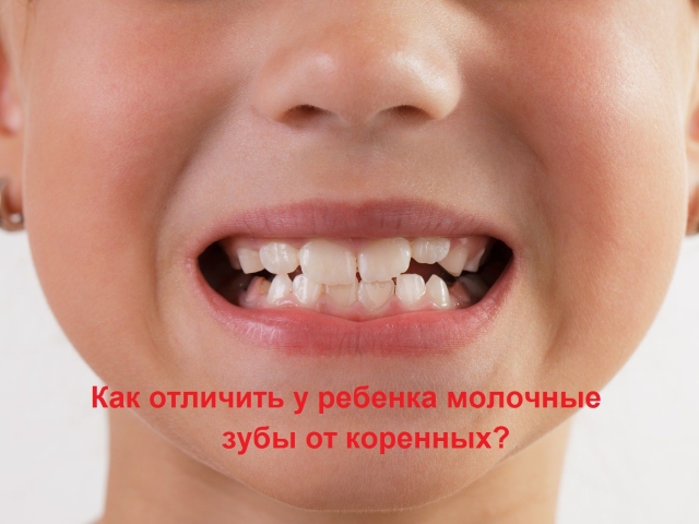 Kako razlikovati mlečni zob od korena: fotografije z razlagami. - Modrost zob - avtohtono ali mleko? Ali se vsi mlečni zobje spremenijo v avtohtone? Kakšne težave so povezane s spremembo mlečnega zoba v korenino: kdaj se naredi x -ray?