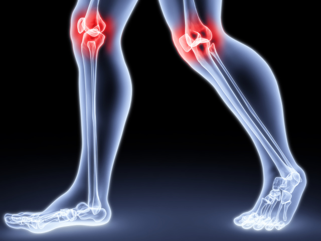 Arthritis and arthrosis: What is the difference, what is worse? The first signs and symptoms of arthritis and arthrosis, diagnosis: Description. Which doctor treats arthritis and arthrosis of the joints?