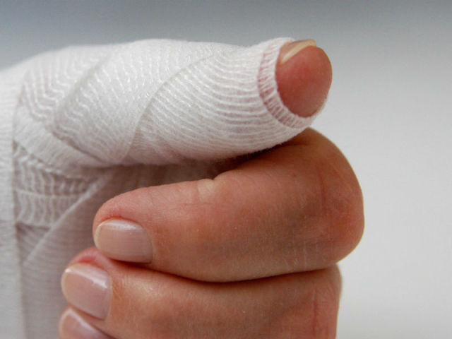 Ecchymose de l'ongle sur la jambe ou la main. Que faire si l'enfant pince l'ongle avec une porte ou une ecchymose: premiers soins, traitement