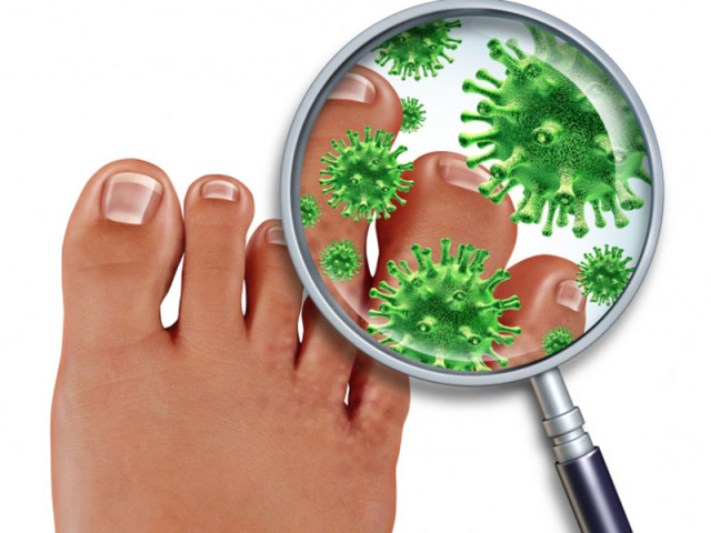 Antifungal drugs for nails and legs, skin, inexpensive, but effective. The best remedy for fungi on the legs: tablets, varnish, cream, ointment, drops