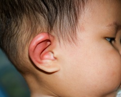 Po uhanih pokuka uho, po preboju: vzroki, zdravljenje