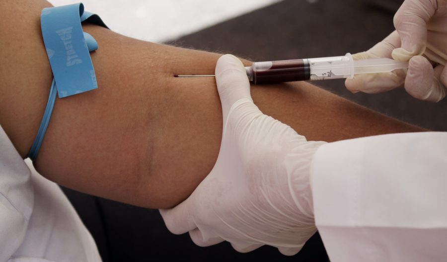 Ποιες δοκιμές παραδίδονται για λοίμωξη και βοηθήματα για τον ιό HIV;