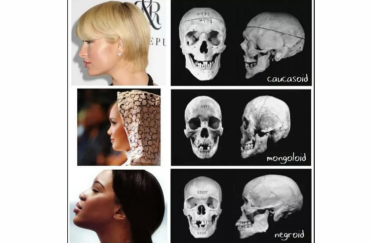 Расовые особенности строения черепа человека