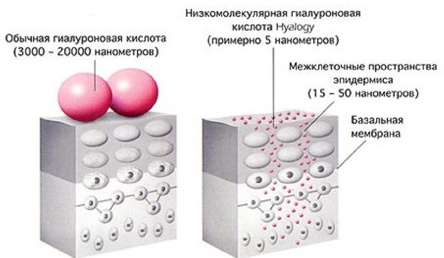 Высокомолекулярная и низкомолекулярная гиалуроновая кислота.