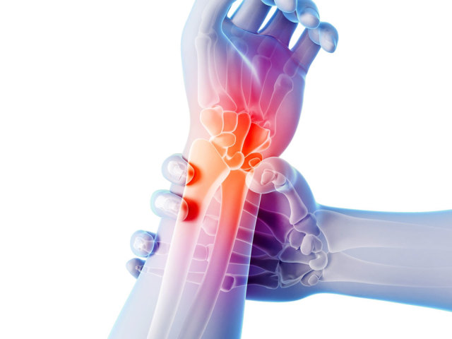Arthritis and arthrosis of the joints: treatment with medical drugs, herbs, folk remedies, exercises, massage, compresses, diet, prevention. Which doctor treats arthritis and arthrosis of the joints?