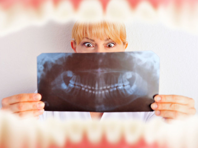 Gigitan yang salah pada orang dewasa. Bagaimana cara menyelaraskan gigi Anda? Menyelaraskan gigi dengan kawat gigi, kappa: foto sebelum dan sesudah. Koreksi gigitan tanpa kawat gigi