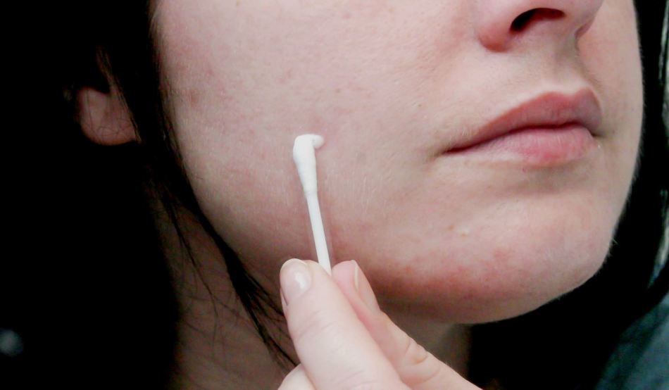 Сплошную маску из зубной пасты на лице делать нельзя, можно наносить только точечно