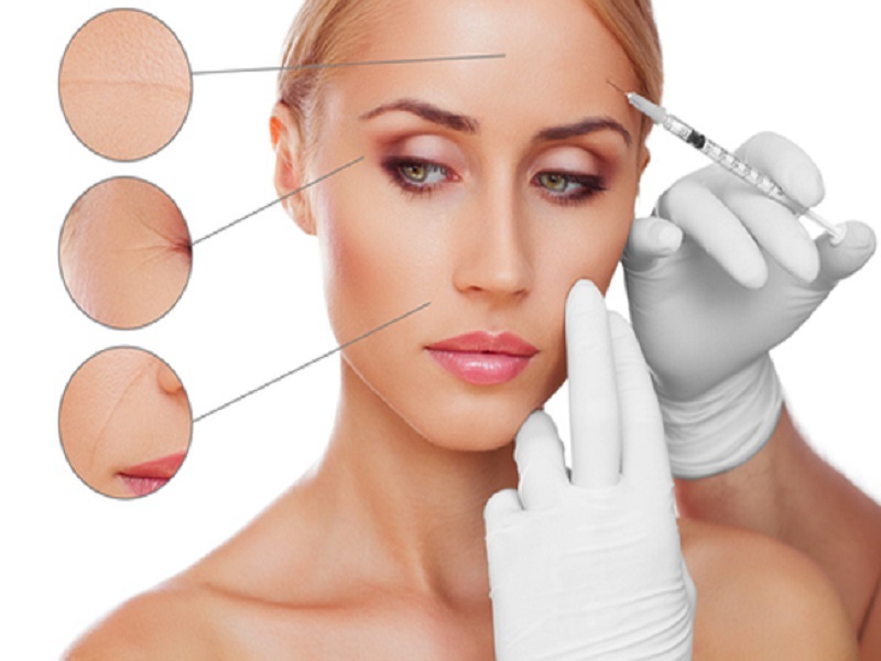 Botox injekciók a homlokon lévő ráncok simításához a leghatékonyabbak