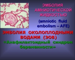 Embolie par le liquide amniotique de la femme en travail dans la césarienne: causes, traitement, prévention. Fournir une assistance d'urgence à une femme en embolie par le liquide amniotique