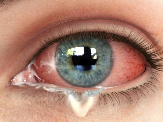 Ločitve od belega očesa: vzroki pene, nitasta izločanja pri odraslih in otrocih, droge, kapljice, folk metode