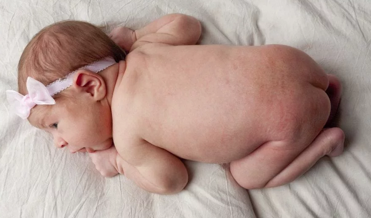 Draževanje kože pri dojenčkih