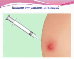 Méthodes efficaces pour éliminer les cônes des injections sur les fesses: que faire, que dissoudre, comment éliminer les joints purulents? Que faire pour que la bosse ne se forme pas après l'injection: prévention, quelle seringue pour l'injection sous-cutanée est utilisée?