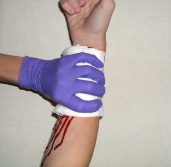 With venous bleeding, a pressure dressing is applied.