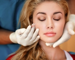 Botox: alergias o contraindicaciones, efectos secundarios: características. El efecto secundario de Botox en su frente, en su rostro, en sus ojos, cerca de la boca, ¿cómo parece? ¿Es una sobredosis de toxina botulínica y qué hacer con ella?