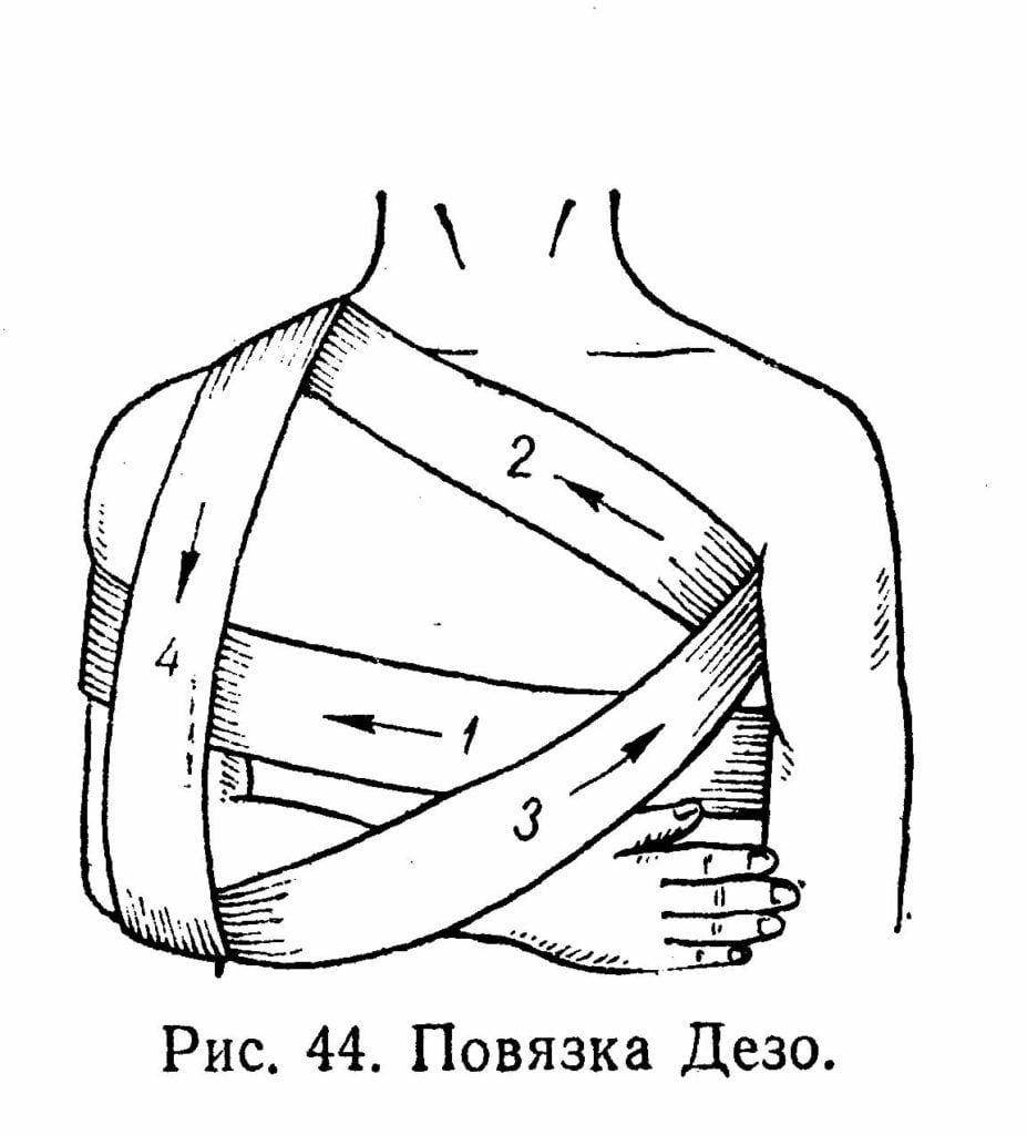 The layout of the dressing