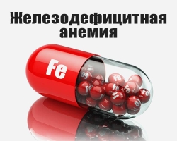 Than iron deficiency anemia differs from iron deficiency: symptoms, signs