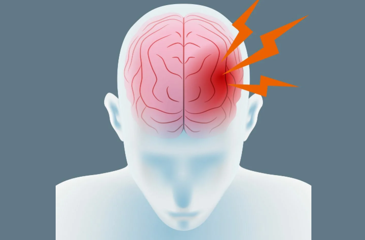 The treatment of a pulsating headache in the left side of the head must be done immediately