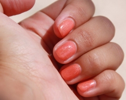 How the allergy to gel polish is manifested and looks: causes, symptoms. What gel polishes cause allergies and which ones are not: the difference between a dangerous fake and the original. How to treat allergies to gel polish drugs, folk remedies and restore nails?